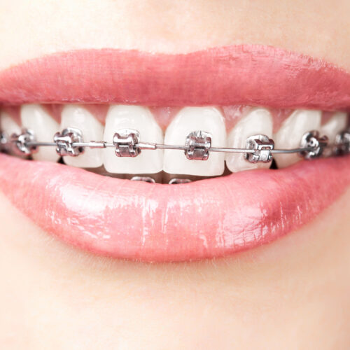 Ortodoncja - Gabinet stomatologiczny