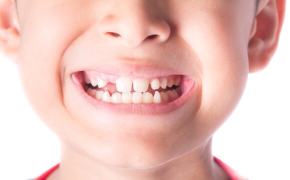 Stomatologia dziecięca - Gabinet stomatologiczny | stomatolog dla dzieci